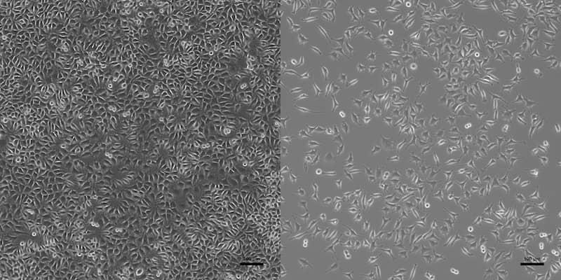 Example under the microscope: In qualitative cytotoxicity testing, there is a difference between non-cytotoxic (left) and cytotoxic (right) samples when they are examined under the microscope.